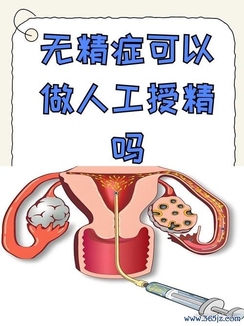 喜助孕宝取精服务专业高效